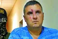 «На сфабрикованому відео ФСБ не впізнав викраденого брата. Його катували…»