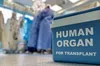 Центр трансплантології Львова став лідером серед медзакладів України з пересадки органів у 2025 році