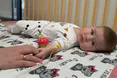 Трьохмісячна Варвара з критичною пухлиною вижила після термінової операції у Львові