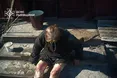 Унаслідок спалювання сухої трави у Золочівському районі постраждали двоє людей