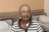 У Львові прооперували чоловіка, якому собака відгриз частину щоки