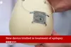 Хлопчику з Великої Британії для контролю епілепсії вперше у світі встановили мозковий імплант