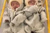 У Львові виходили малюків із критичною вагою: деталі