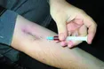 Наркотики косять і «золоту» молодь, і дворових розбишак