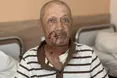 «Собака цілився зубами у шию…»