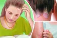 Випробувано на власній шкірі
