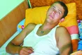 Лише один поранений зі ста залишиться інвалідом...