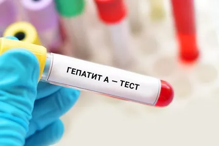 Фото умовне