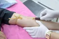 У Штатах схвалили перший аналіз крові на хворобу Альцгеймера: як це відбувається
