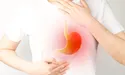 Печія: як погасити «пожежу»?