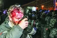 «Беркут» свідомо бив журналістів, щоб не було жахливих фото»